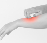 עלייה ניכרת במספר קורבנות קדחת הנילוס המערבי-תמונה